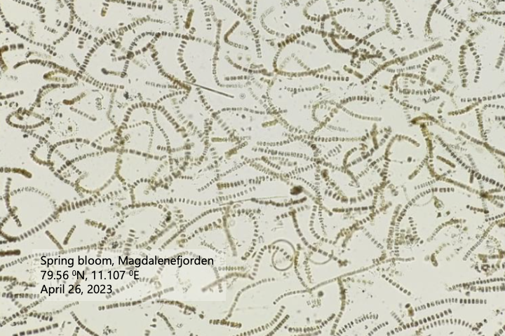 phytoplankton bloom - planktoscope Diatoms collected in Magdalenefjorden on April 26, 2023. Picture captured by the PlanktoScope