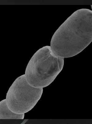 Filaments of Ca. Thiomargarita magnifica