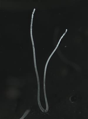 Filaments of Ca. Thiomargarita magnifica