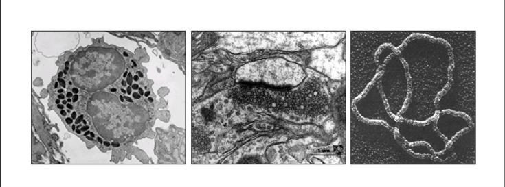 International research collaboration seeks to develop non-invasive quantum electron microscope